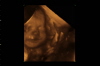 IMAGES_3